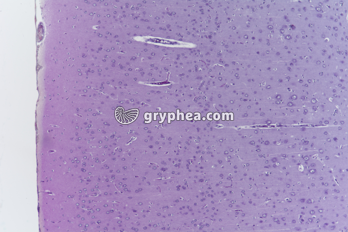 Encéphale CL coupe totale (détail des cellules) x25 - gryphea.com